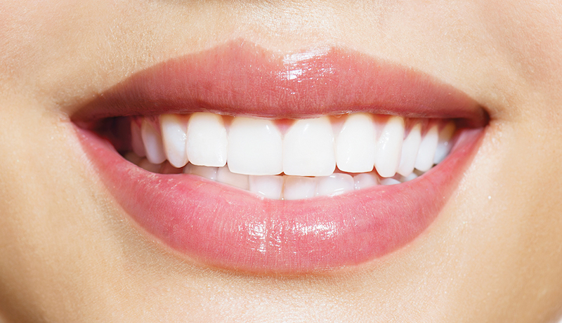 Sourire